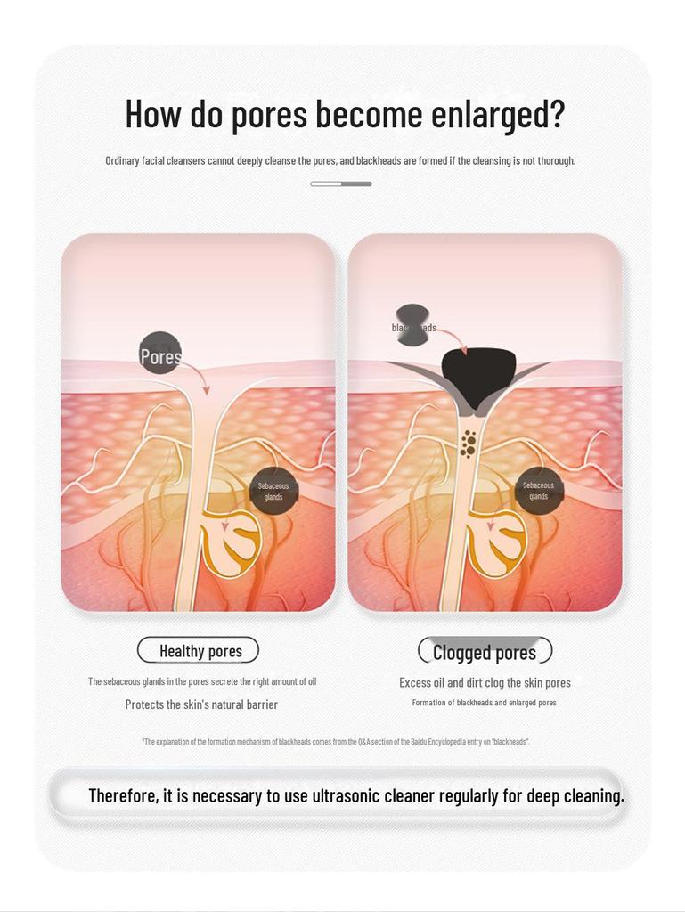 Ultrasonic Skin Scraper & Blackhead Remover: Deep-Cleansing Beauty Instrument & Face Cleanser.