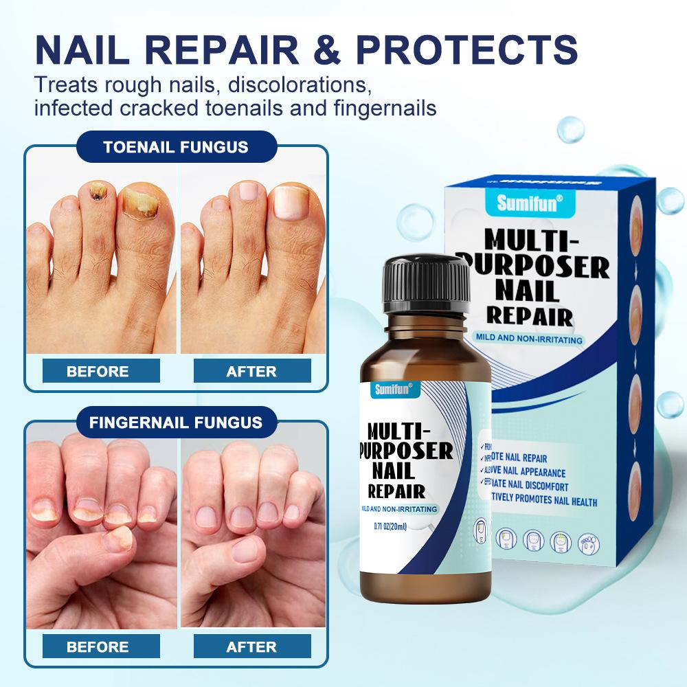 Gray Nail Paste, Thickened Shiny Nail, Gray Nail Repairs, Clean and Soft Nail Paste, Care for Hand, Foot and Toenail Decay