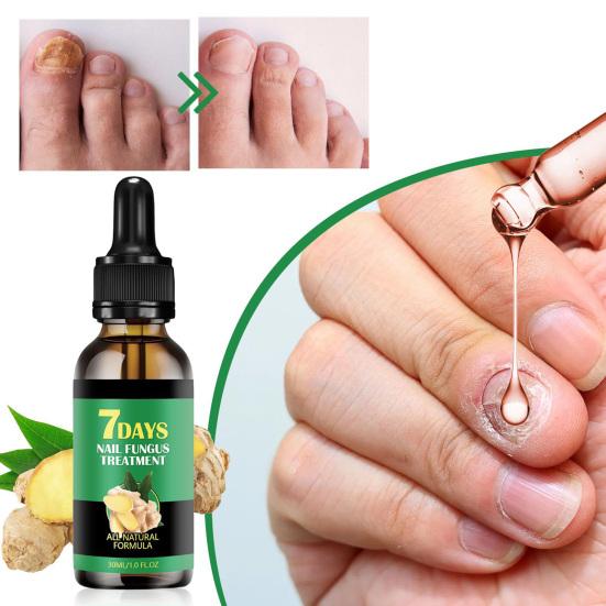 30ml Nail Growth Serum Ginger Nail Treatment Nail Growth Repair Essential Oils