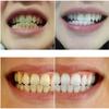 105g Toothpaste Teeth Whitening Refresh Breath Stain Remove White Teeth Cleaning Hygiene Oral Care Dental Toothpaste Clean Teeth Ordor Remover
