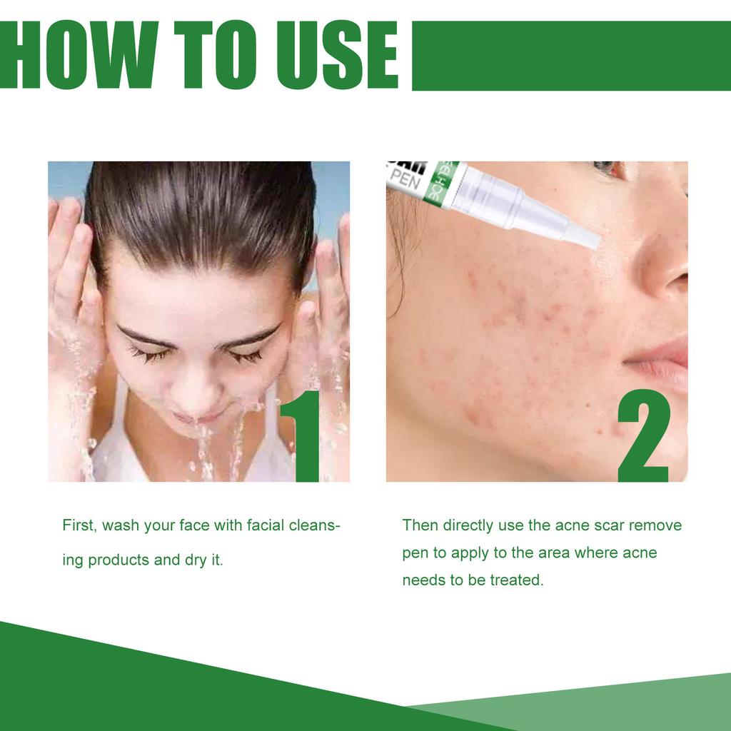 EELHOE Herbal Acne Removal Pen Oil Control Anti-Acne Gel Treatment Acne Mark Skin Care Whitening Eliminate Pimples Facial Cream
