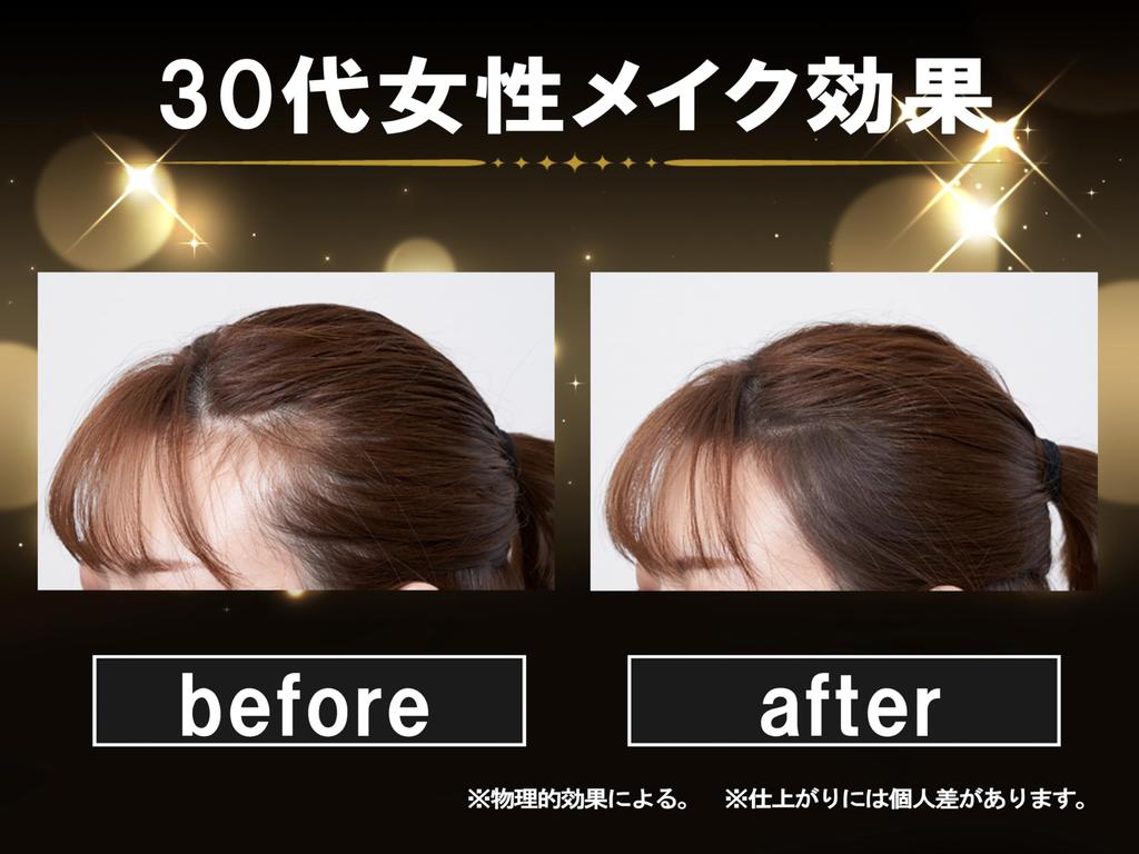 Lalachuu Hair Foundation Premium N Dark Brown Light Brown Body lalachuu Скрывает седину, увеличивает, скрывает истончение волос, увеличивает облысение по линии роста волос