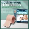 South Moon Skin Concealer Patches – Lightweight Water-Resistant Body Concealing Patches for Scars, Tattoos & Blemishes, Natural Coverage