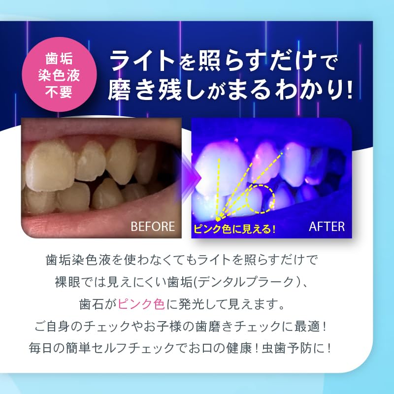 [Выявляйте скрытый налет с первого взгляда] OMNI Индикатор зубного налета (черный)