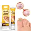 Nail Fungus Treatment Ointment, Nail Repair Cream for Onychomycosis, Toenail Fungus, and Nail Infections, 20g