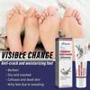 Ximonth Foot Care Cream - Relieves, Moisturizes, And Protects Heels From Dryness, Cracking, Peeling, And Provides Hydration And Foot Care