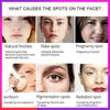 Новейший крем-корректор темных пятен, отбеливающий крем для лица, ремонт, выцветание веснушек, удаление темных пятен, средство для удаления меланина, осветляющий крем для лица
