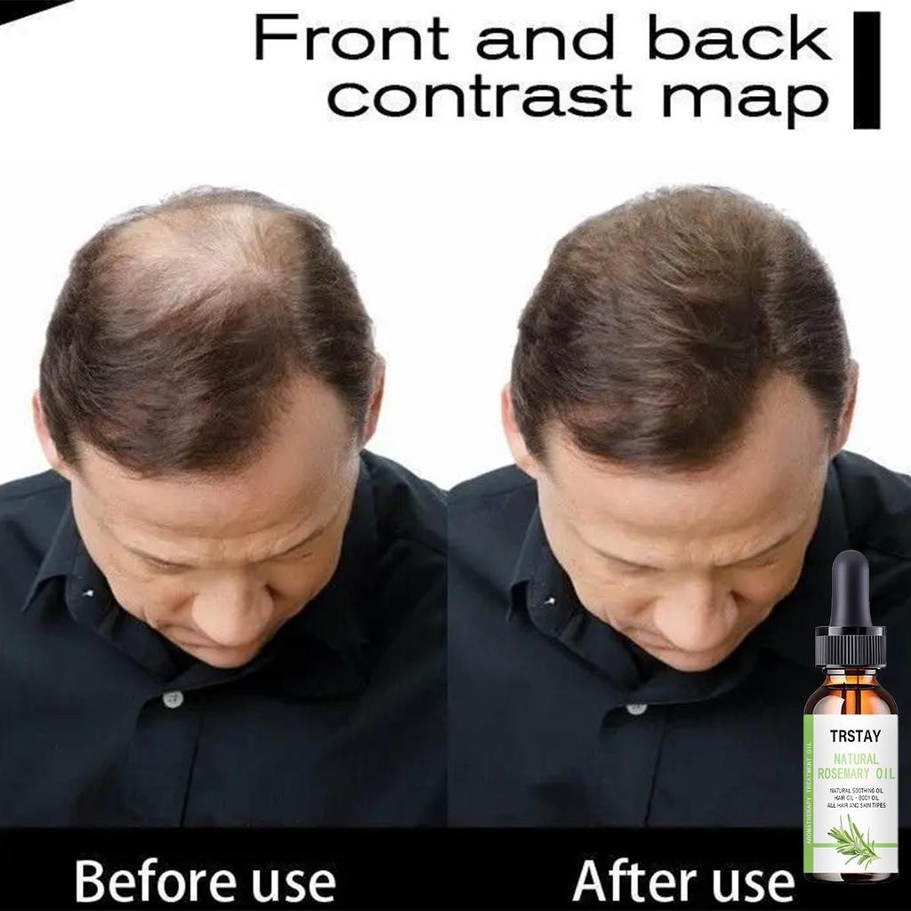 5 мл/15 мл/30 мл/50 мл/натуральная растительная эссенция, кондиционер для быстрого роста, шампунь для ухода за волосами, косметический инструмент без выпадения волос