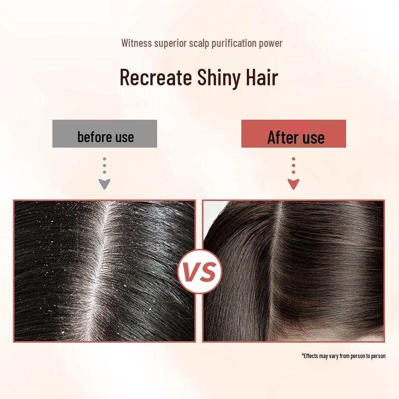 Ziyuan Tea Seed Hydrating Anti-dandruff Shampoo