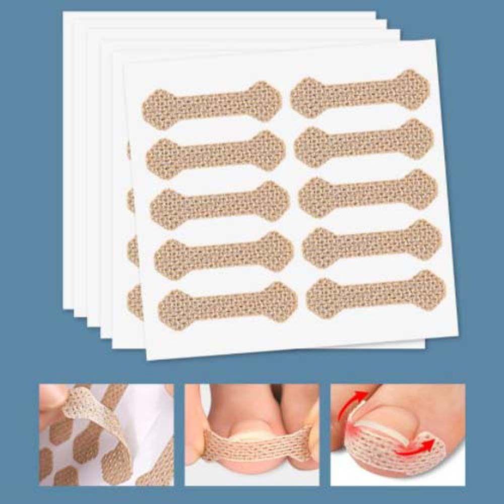 10 шт./компл. инструмент для коррекции ногтей на ногах, эластичные накладки для ухода за ногтями, брекеты для педикюра, инструменты для коррекции ногтей, наклейки