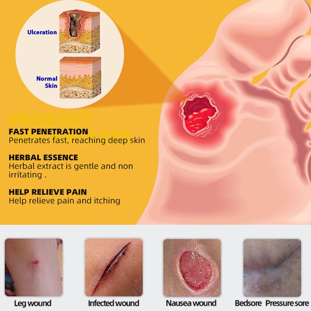 Bee Decubitus Cream Pressure Ulcer Care Elderly Health Skin Care Ointment Reduces Itching And Pain Inhibiting Skin Cream 20g