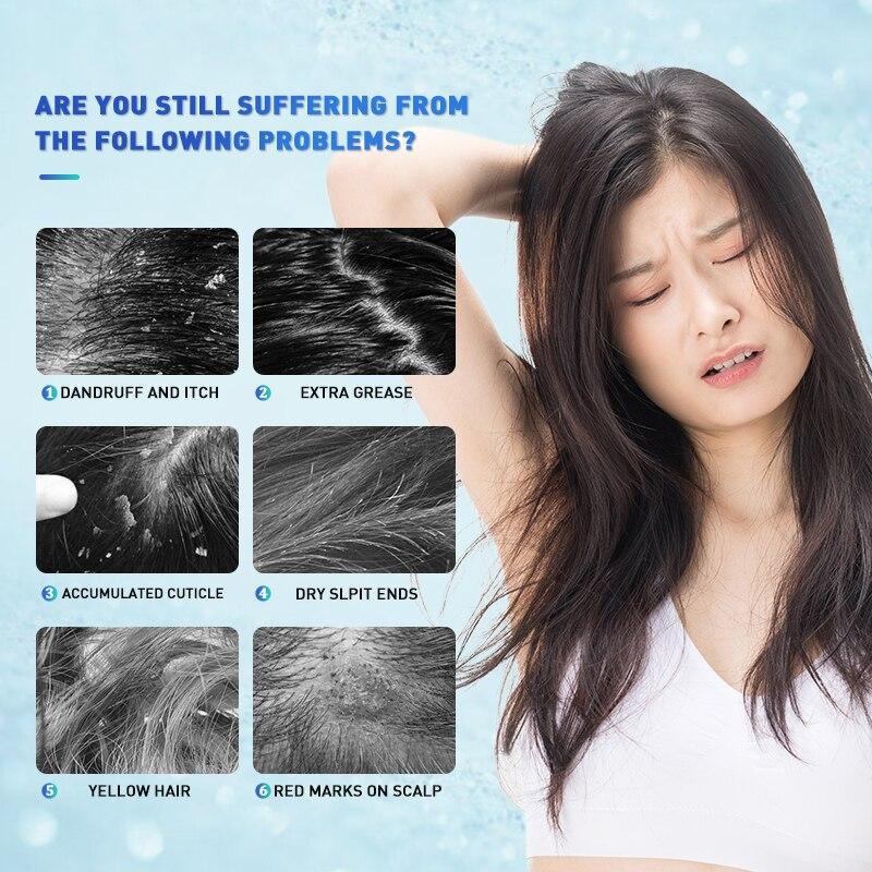 PURC Гель для кожи головы от перхоти, отшелушивающий, освежающий, против зуда, питательный продукт для ухода за волосами, 60 мл