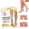 Veinhealing Varicose Veins Ease Plaster, Veinhealing Varicose Veins Plaster, Varicose Veins Ease Plaster 12PC