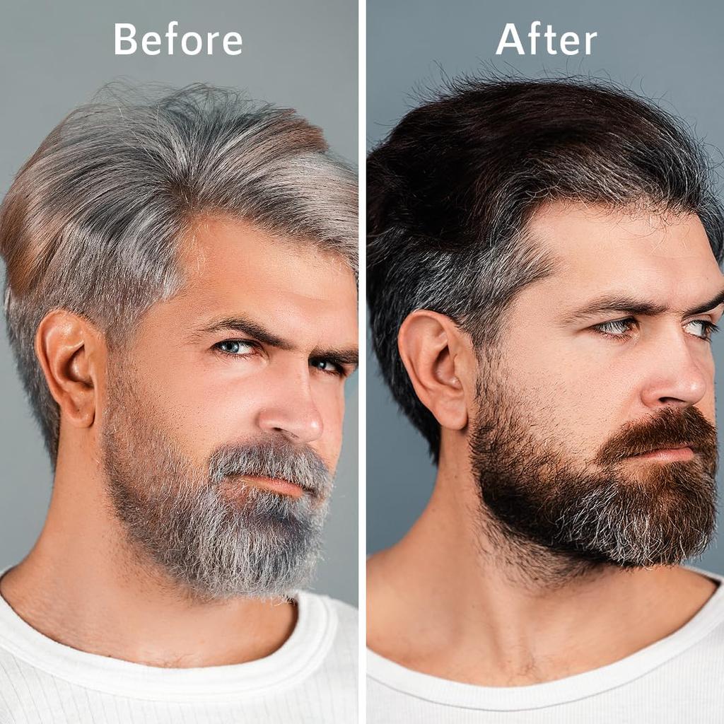 Сыворотка для волос nti-Gray с Arcolys, Melanogray, маслом черного тмина и экстрактом гибискуса | Легкая, нелипкая формула, без парабенов и без жестокого обращения с животными, 50 мл