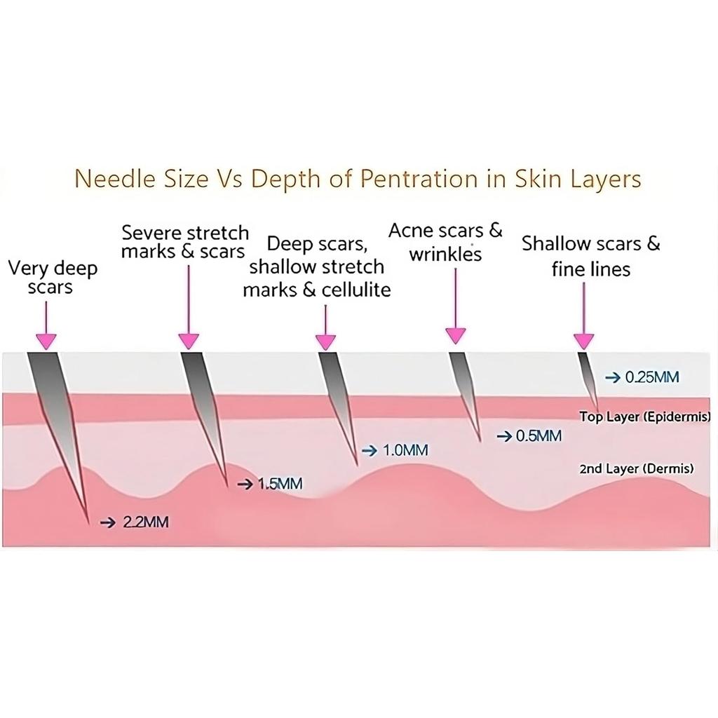 Дермароллер для роста волос для мужчин и женщин, 540 титановых микроигольчатых роллеров для роста волос, роллер для бороды для ухода за кожей и роста бороды