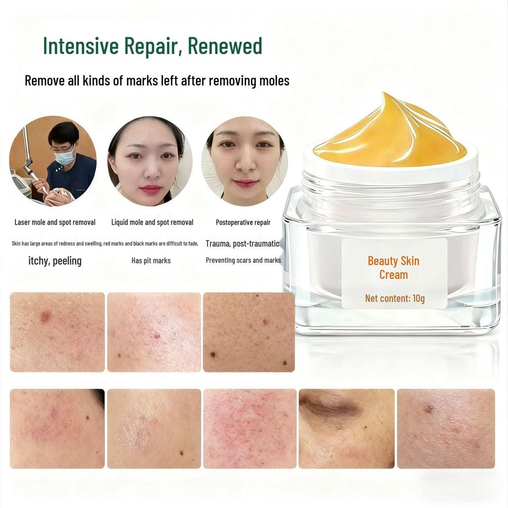 Восстанавливающий крем от солнечных ожогов, веснушек и родинок - Питает, уменьшает покраснение и отечность, успокаивает кожу - Эксклюзив для салонов