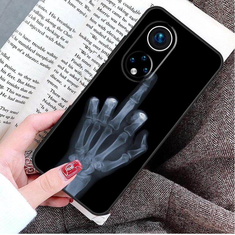 Чехол «Средний палец» для Honor Magic 8 5 6 7 Lite Honor 200 400 Pro 50 70 90 X9d X9b X9c X9a X8c X8b Win RT