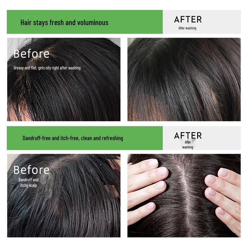 Cai Le Anti-Dandruff Oil Control Shampoo 420ml