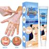 Vitiligo Cream, Natural Vitiligo Relief Skin Vitiligo, Vitiligo Care Cream, Reduce White Spots, Improve Skin Pigmentation