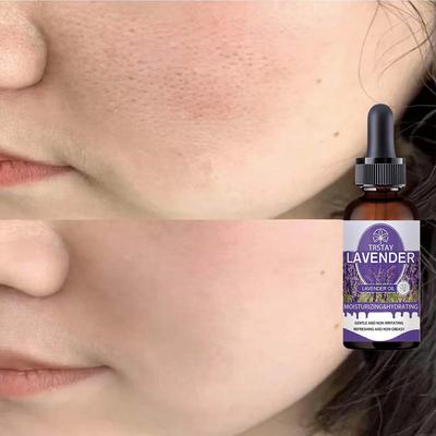 Новейшее чистое натуральное растительное эфирное масло розы и лаванды. Массажное эфирное масло защищает кожу. Свежий воздух снимает стресс.