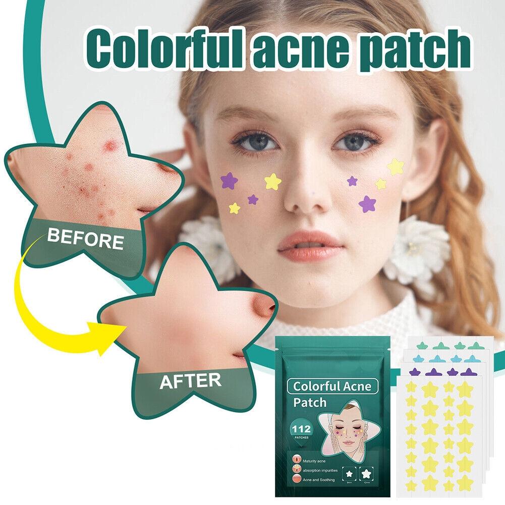 112pcs Invisible Acne Removal Pimple Patch Cute Star Shaped for Face Healing