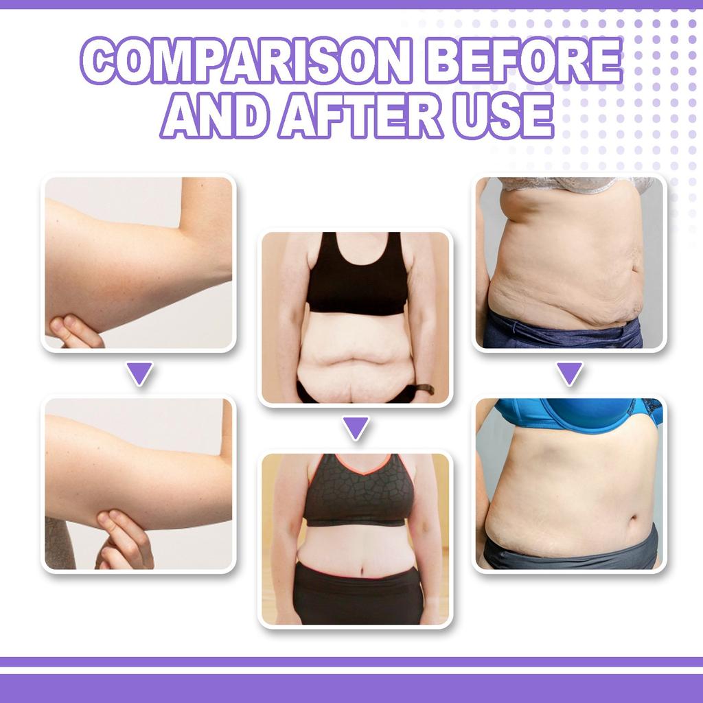 Уход за кожей с растяжками и дряблостью 2 в 1 Укрепляющий лосьон для растяжек и дряблости кожи 100 мл