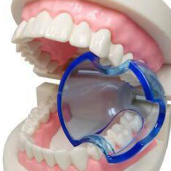 Yousheng Mouth Opener Простой в эксплуатации мини-портативный открыватель рта для задних зубов для взрослых