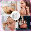 8-Piece Acne Extraction Tool Set In Stainless Steel Box, Professional For Spas And Beauty Salons (Includes Free 10Pcs Pad)