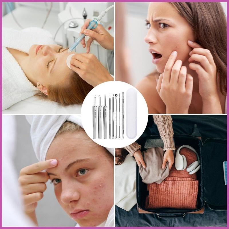 8-Piece Acne Extraction Tool Set In Stainless Steel Box, Professional For Spas And Beauty Salons (Includes Free 10Pcs Pad)