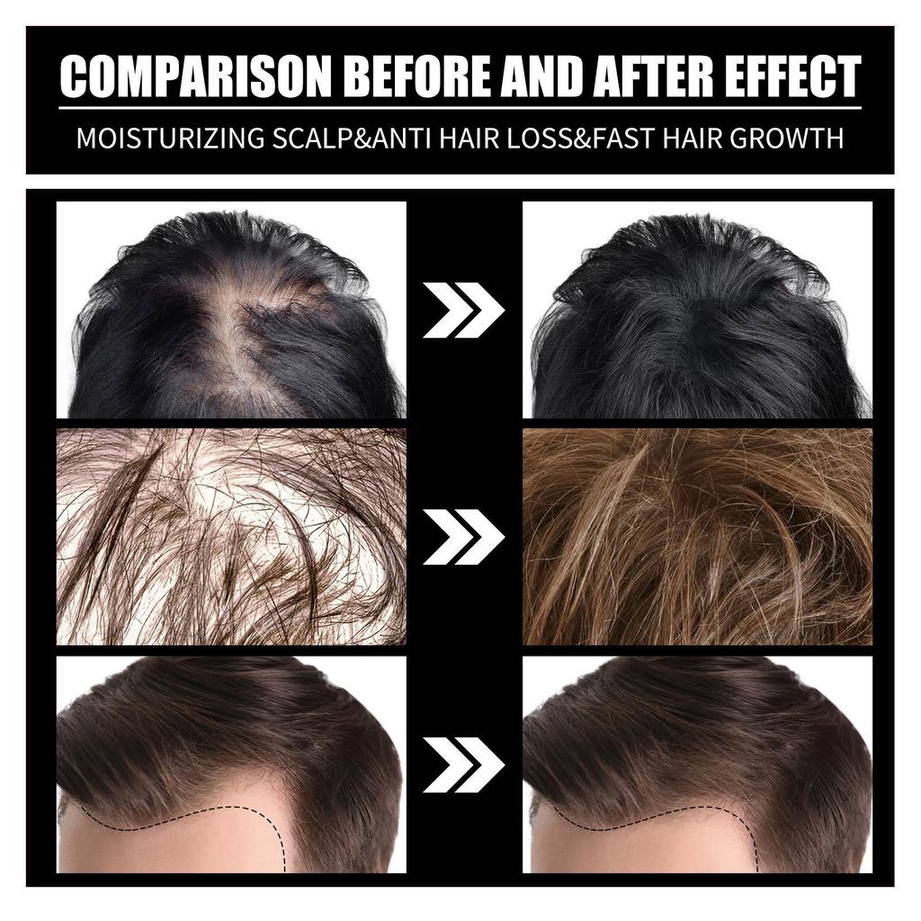 Collagen B7 Biotin Hair Care Oil Nourishing Gentle Smoothing Treatment less