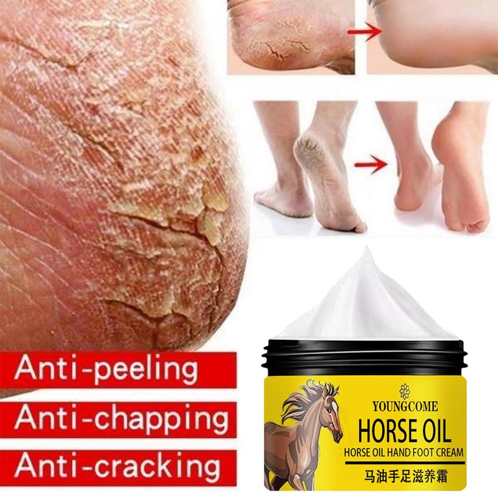 Gentle and Non-irritating, the Chapped Foot Repair Cream Hydrates and Nourishes the Skin, Leaving It Soft and Delicate