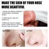 Safe Healthy Multifunctional Universal Mild Clean Acne Gentle Nose Plants Pores Strips