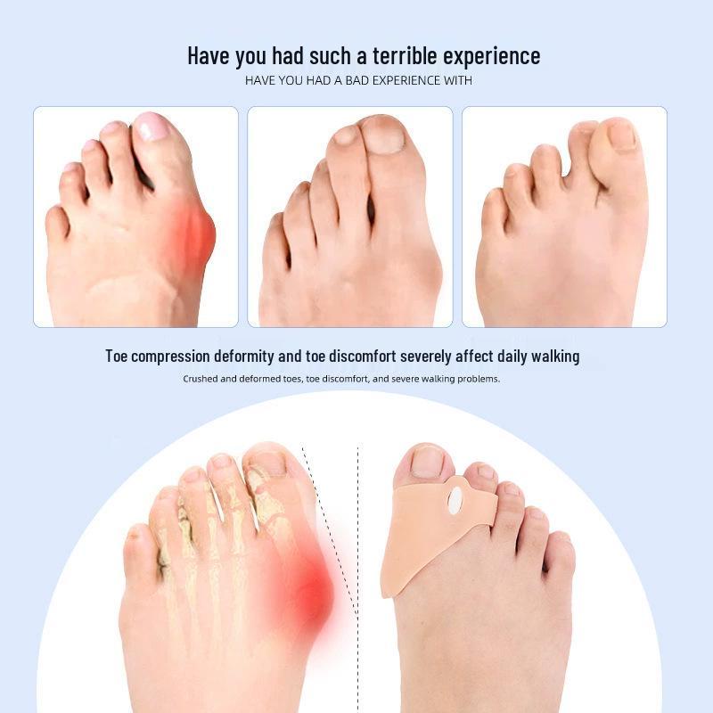 Adjustable Silicone Toe Separator & Corrector for Overlapping Thumb and Little Toe Alignment