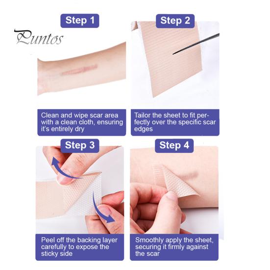 Силиконовые пластыри для рубцов, рулон ленты для рубцов, профессиональные мягкие полоски для рубцов после хирургических операций, келоидные рубцы, лечение угревой сыпи, силиконовый гелевый пластырь