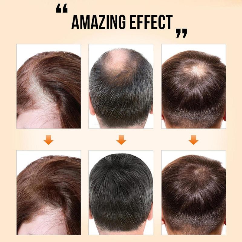 2023 Ginger Hair Density Essential Oil, Hair Regrowth Essence for Women & Men
