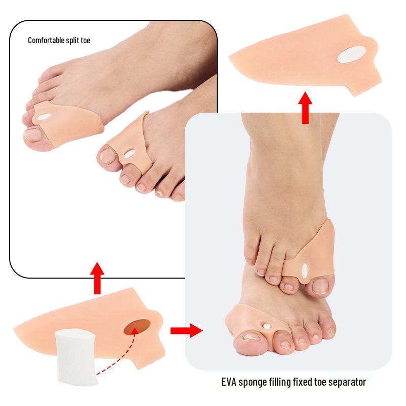 Adjustable Silicone Toe Separator & Corrector for Overlapping Thumb and Little Toe Alignment