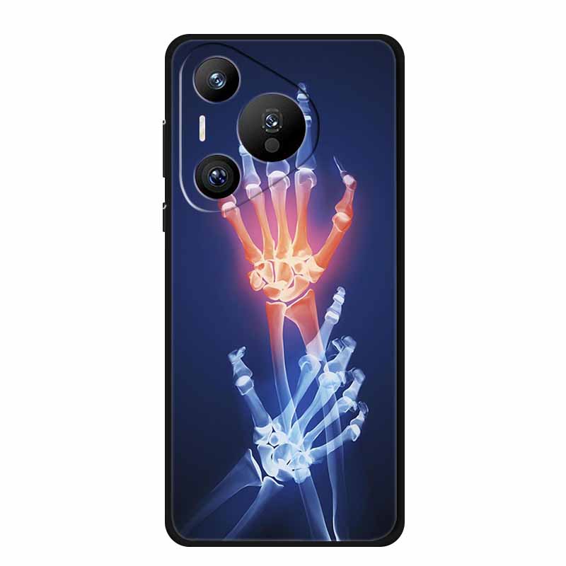 Чехол для Honor 400 Pro Honor400 Pro Coque Ударопрочный Черный Силикон ТПУ Мягкая Задняя Крышка Для Honor 400 Pro Чехлы для Телефона 400Pro Сумка