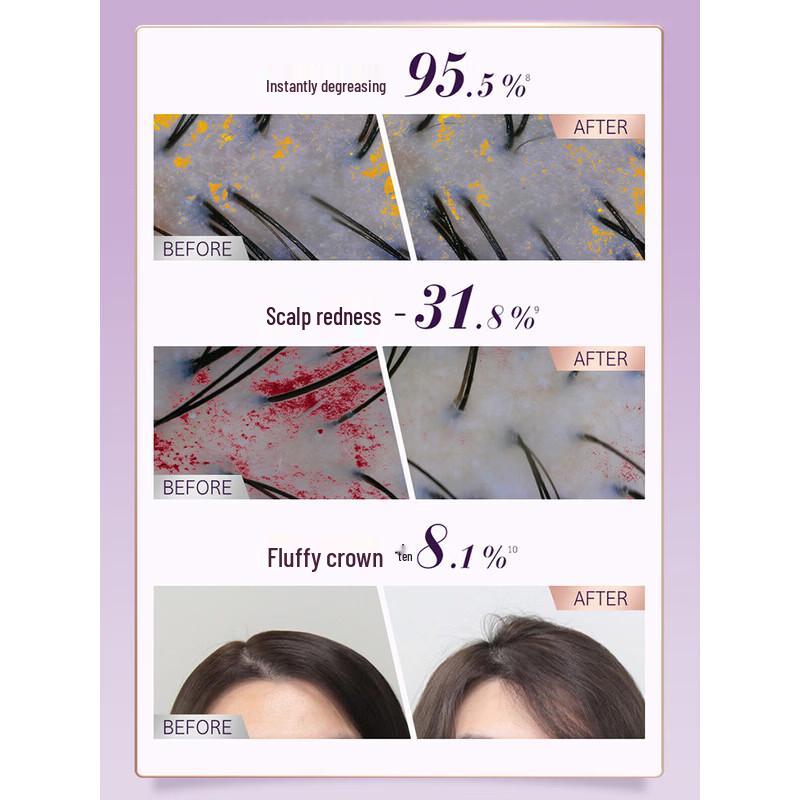 Ryo Purple Anti-Hair Loss & Volumizing Shampoo
