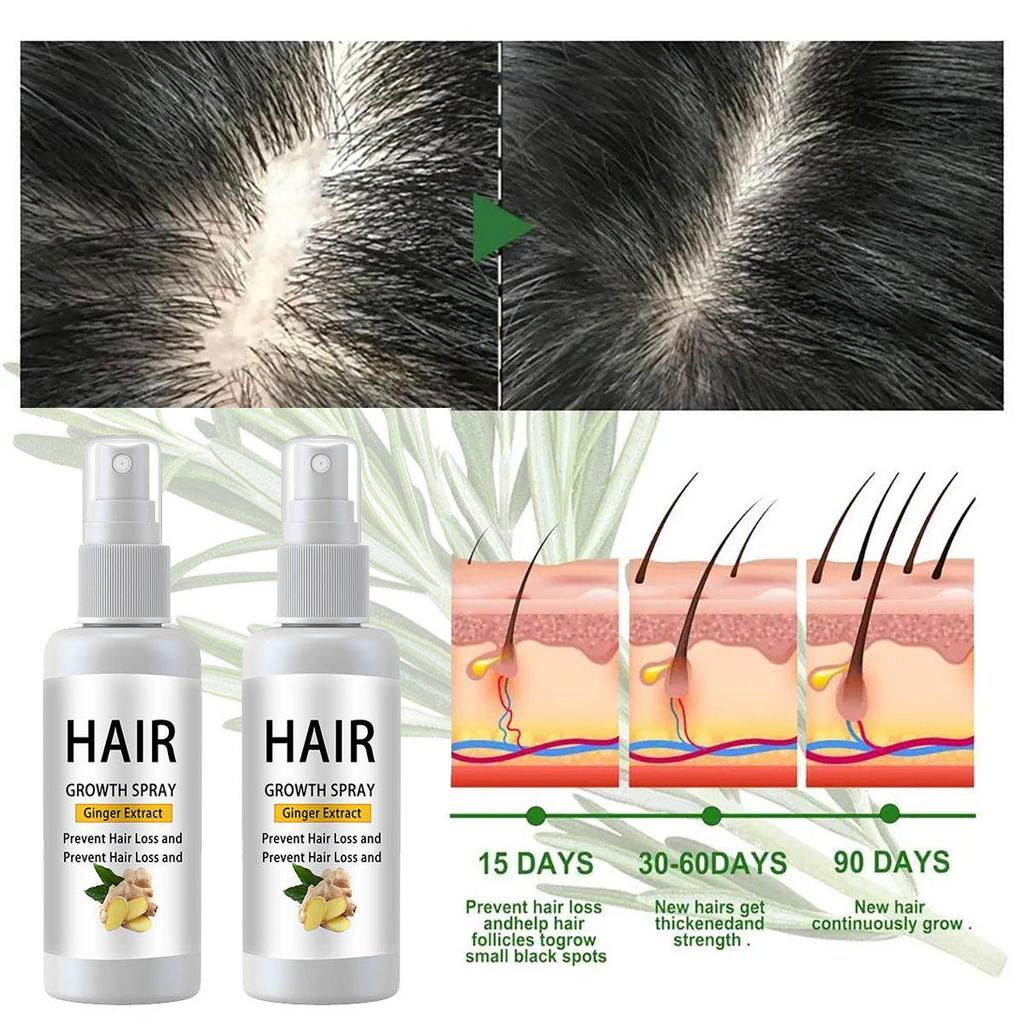 Hair Growth Product, Rosemary Growing Hair Essential Oil Beauty Hair Care, Prevent Hair Loss