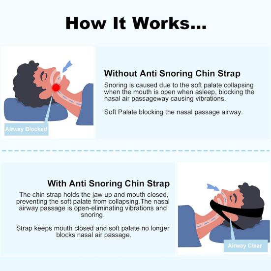 Пояс против храпа Эффективное уменьшение храпа Подбородочный ремень Дышащий ремень против храпа для мужчин и женщин