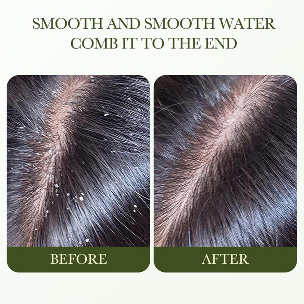 Питательный шампунь против перхоти с оливковым маслом, увлажняет и восстанавливает сухую и зудящую кожу головы, 500 мл