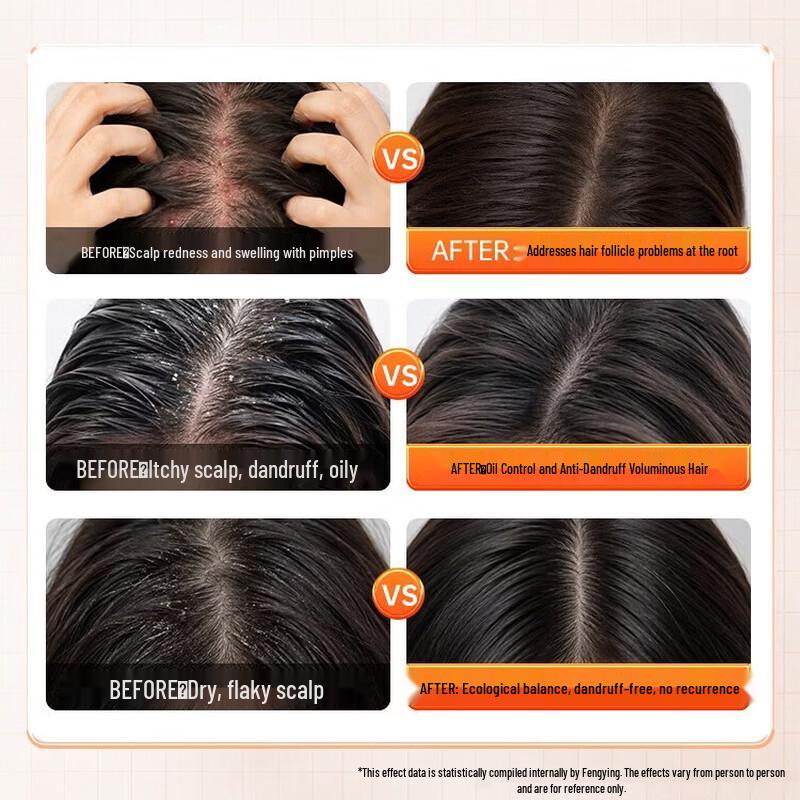 Fengying Selenium Sulfide Anti-Dandruff Refreshing Shampoo