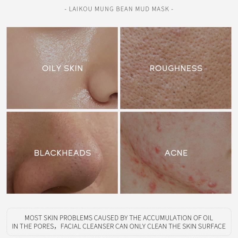 5 шт./10 шт. Маска из пасты бобов мунг, очищающая маска для лица, грязь для удаления черных точек и закрытия рта