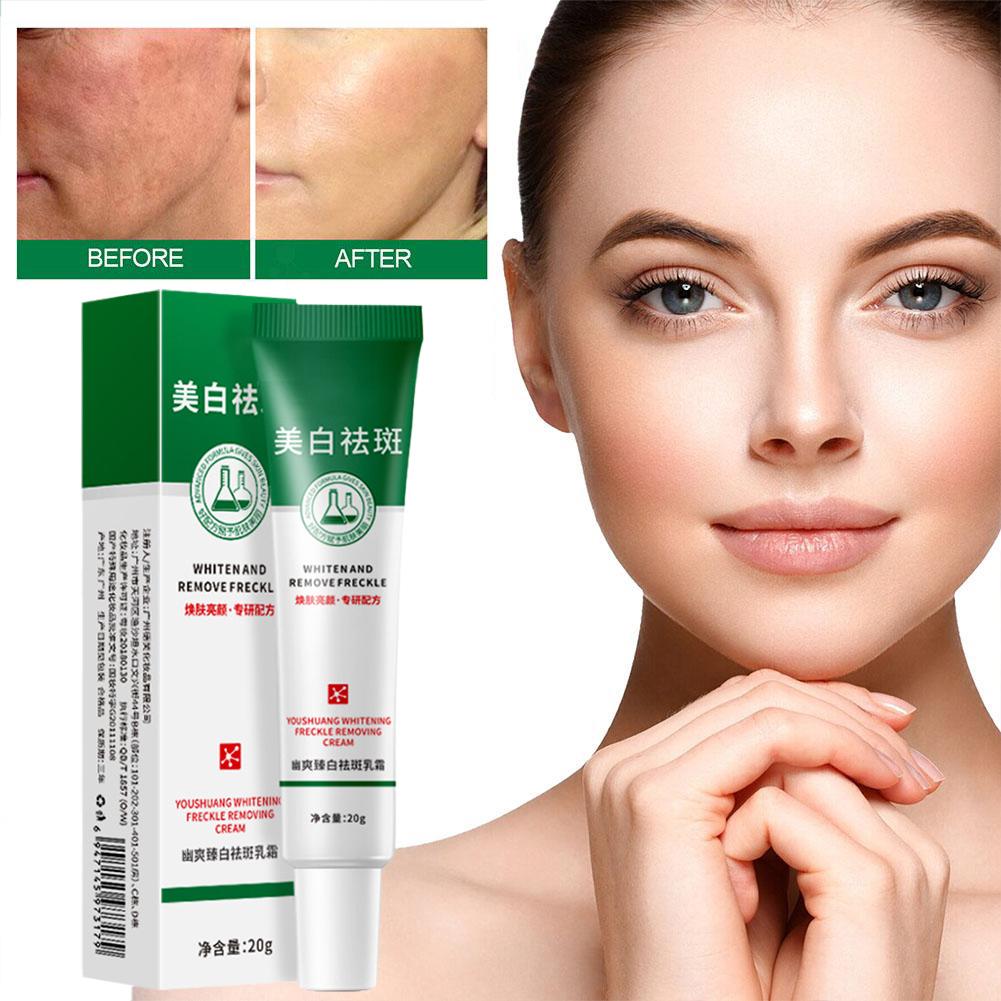 20 г отбеливающий крем от веснушек для удаления темных пятен на лице крем от мелазмы осветляет пигментацию лыжи P9L3