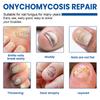 60Pcs Toenail Fungus Treatment Patches Sticky Nail Ingrown Care Correction Stickers for Paronychia Nail Repair