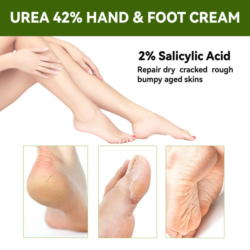 50g Urea Foot Cream Hand Anti Cracking Moisturizing Calluses Dead Skin Repair Rehydration Soften Cuticle Smooth Restore