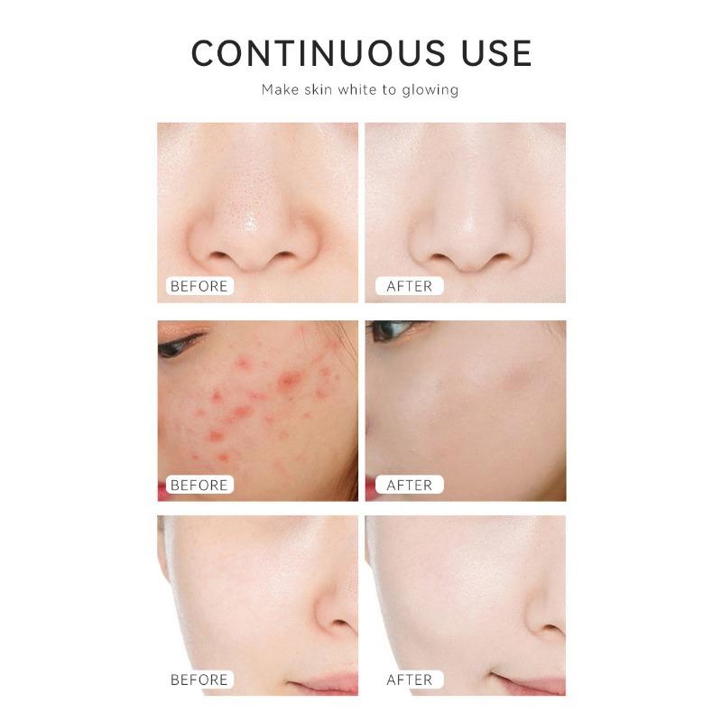 Компактная жидкая эссенция против морщин, растворимое в масле средство для точечного нанесения, антивозрастное решение для лица