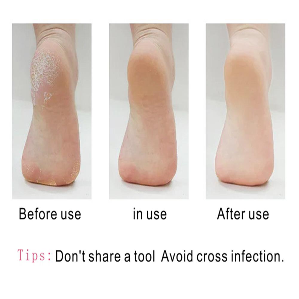 Grinding Stones Foot Care File Cuticle Cleaner Hard Dead Skin  Remover Foot Rasp Pedicure File