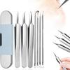 Набор из 7 инструментов для удаления черных точек из нержавеющей стали, набор для удаления комедонов, зажимов для прыщей, пинцетов для носа и лица
