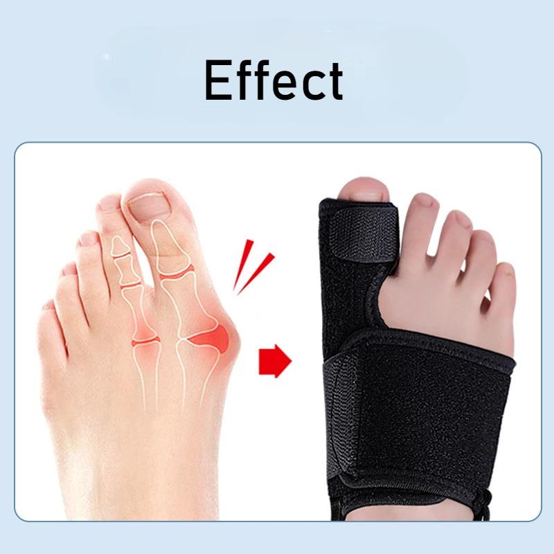 Flexible Splint Toe Separator Hallux Valgus Bunion Corrector Orthotics Feet Bone Thumb Adjuster Correction Pedicure Straightener